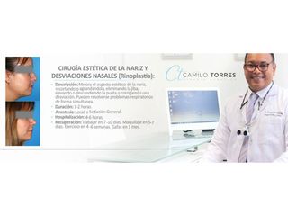 Rinoplastia - Dr. Camilo Rafael Torres Rodríguez