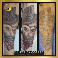 Borrar tatuajes - Dr. Fabian Correa