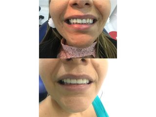 Ortodoncia - Clínica Oral A1