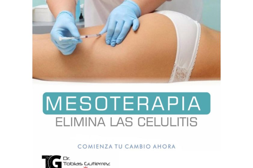 Mesoterapia antes y después - 639802