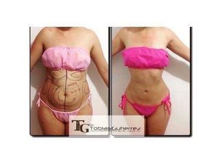 Lipoescultura