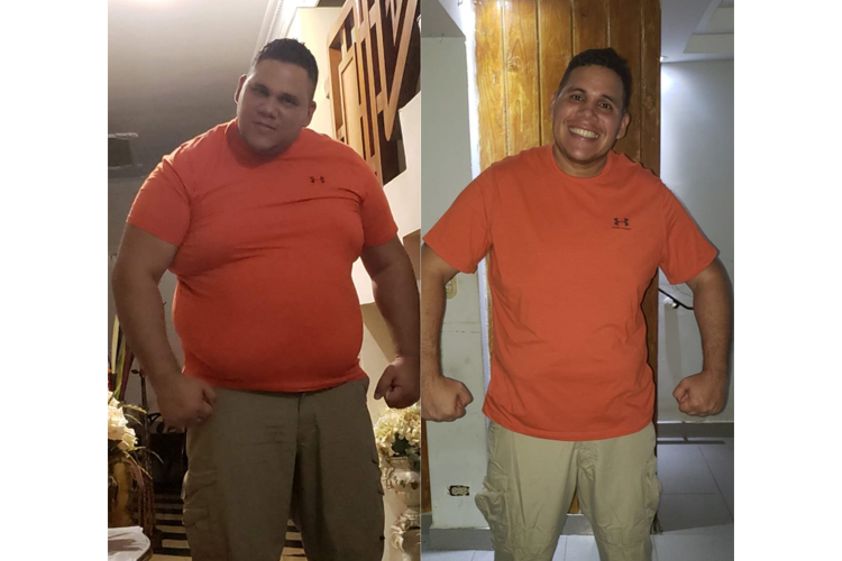 Manga Gástrica antes y después - 662809
