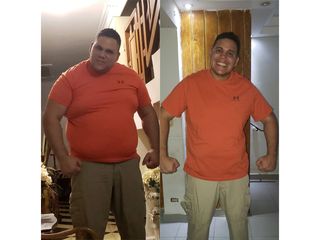 Cristian: 1 año, -44 kilos, manga gástrica - Dr. Diego Lozano