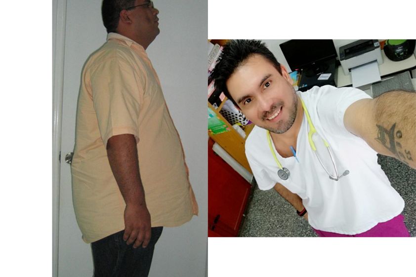 Manga Gástrica antes y después - 662811
