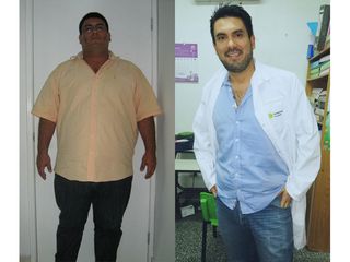 Manga gástrica, 11 años, -75 kilos - Dr. Diego Lozano