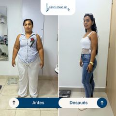Manga Gástrica - Dr. Diego Lozano R.
