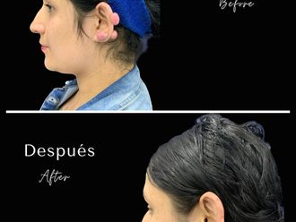 Cirugía reconstructiva antes y después - 852015