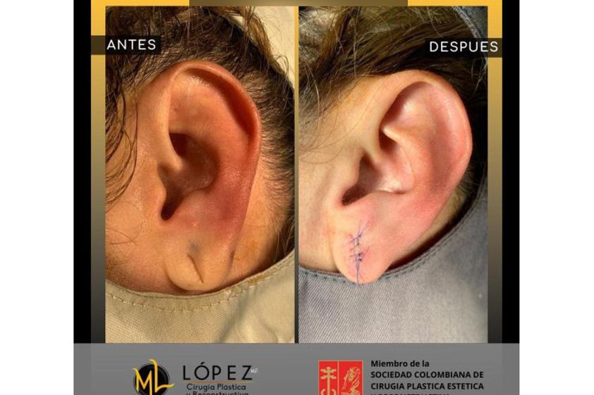 Cirugía reconstructiva antes y después - 697703