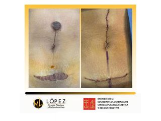 Cirugía reconstructiva - Dr. Miguel Lopez