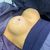 Mamoplastia de aumento con pexia periareolar
