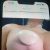 Maxtopexia con liposuccion