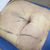 Muy satisfecha con mi procedimiento de lipolisis laser