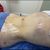 Muy satisfecha con mi procedimiento de lipolisis laser