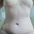 Abdominoplastia lipotrasferencia maxtopexia 😊