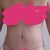 Abdominoplastia: cuidados y sugerencias