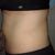 Conseguí bajar de peso pero mi abdomen sigue sin estar perfecto