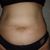 Conseguí bajar de peso pero mi abdomen sigue sin estar perfecto