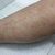 Depilación laser, maravillosa y con mucha experiencia