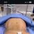 Mi lipotransferencia  con el Dr. Felipe Galiano