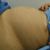 ✨✨ Me realice una abdominoplastía y estoy feliz ✨✨
