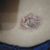 Insatisfecha con adominoplastia
