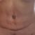 Abdominoplastia, lipo, e inyección glútea. Excelente, me siento otra 😊