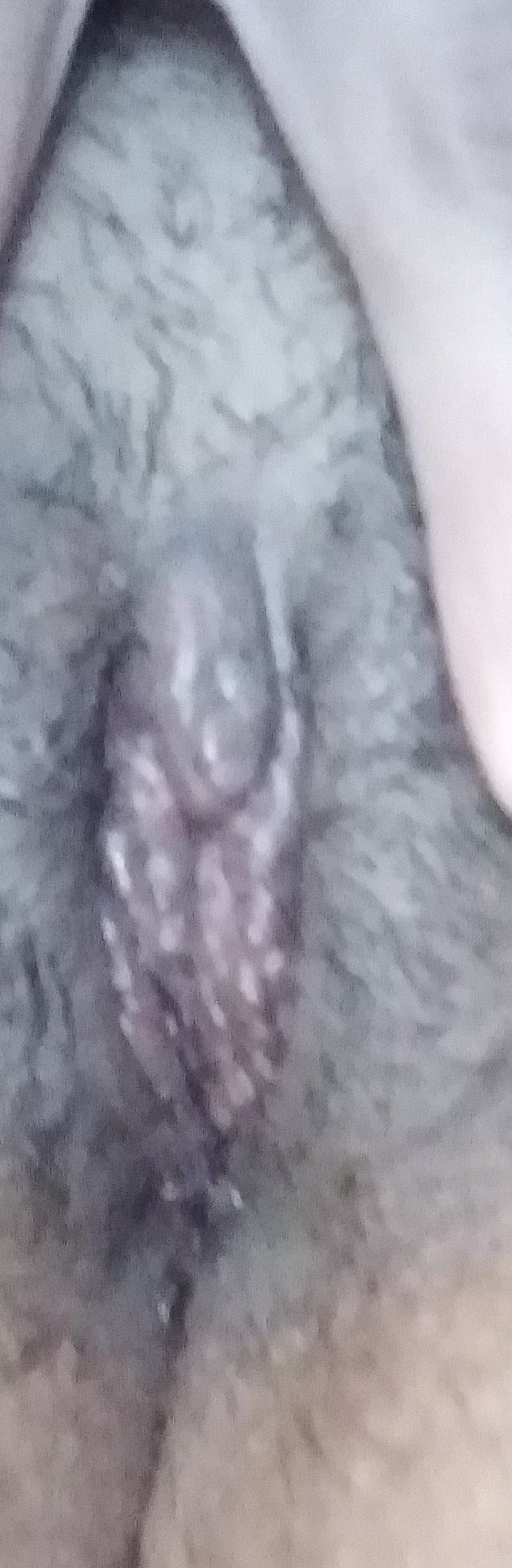 10096