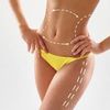 Dudas de lipoescultura: alimentación, cuidados y fajas