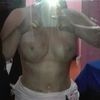 busco cirujano plastico para reaizarme abdominoplastia .experiencias y costos