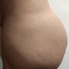  "Mi experiencia con el Retiro de Biopolímeros