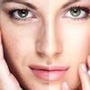 El mejor tratamiento para rejuvenecimiento facial?
