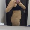 Abdominoplastia lipo y transferencia