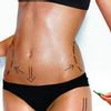 Resultados de Liposucción