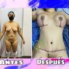 Smart cirugia plastica
