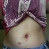 Jaime lozada tristemente me abandono en mi post-operatorio