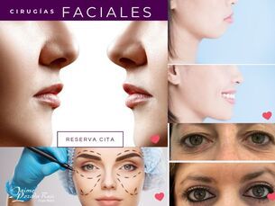 Cirugía Plástica Facial