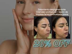 Cosmelan Black Week: Trata manchas, melasmas y daño solar.