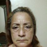 Anónimo