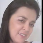 Anónimo