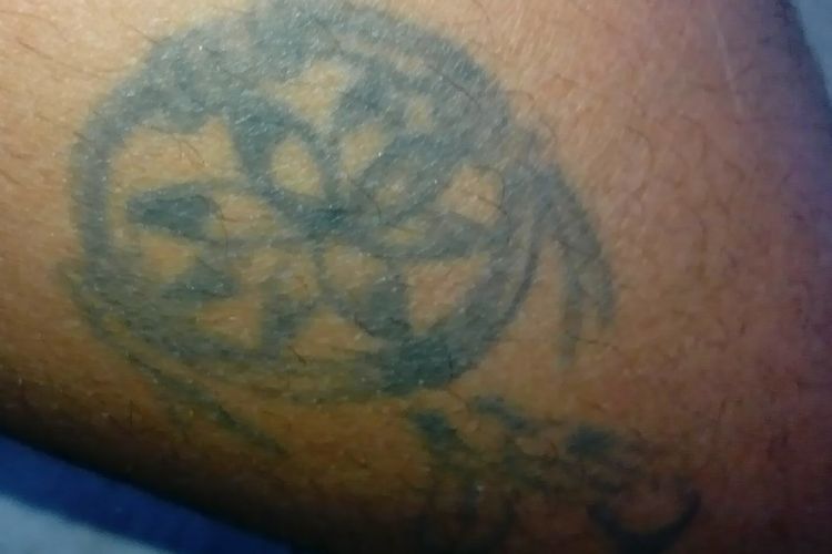 Que cuesta borrar un tatuaje