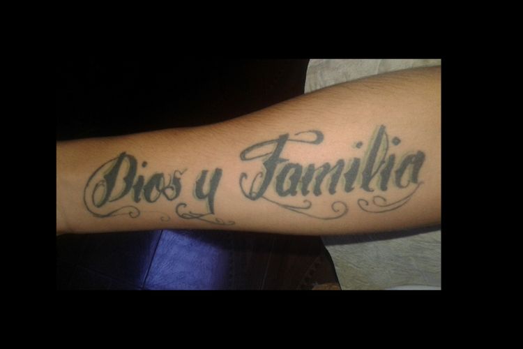 Borrar Tatuaje con Láser