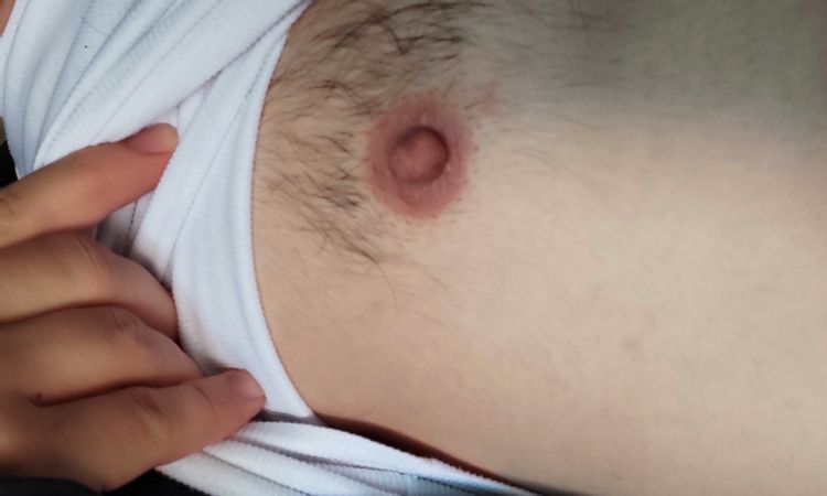 Pezones grandes en hombres. - 16275