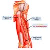 Cirugía reconstructiva del músculo brachialis y/o vasto interno - 46326