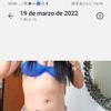 ¿Cuántas veces se puede realizar una lipoescultura?