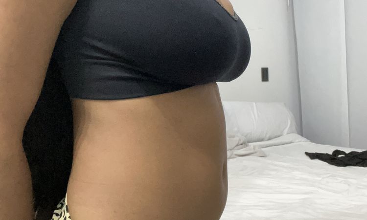 Soy candidata a una lipotranferencia de glúteos? - 54119