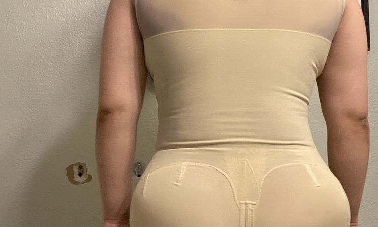 Nalgas de diferente tamaño después de cirugía. - 65107