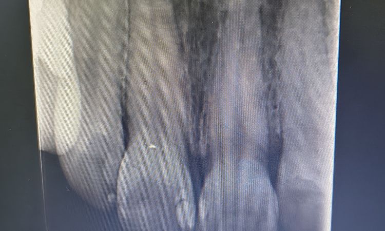 Es para endodoncia, periodoncista, cirugía oral o que és? - 84593