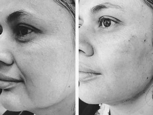 Resultados de los hilos tensores