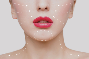 Qué es el ácido hialurónico