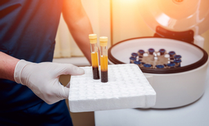 Plasma Rico en Plaquetas